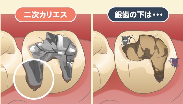 新琴似（札幌市北区）の歯医者、ふれあいの杜歯科・こども歯科の審美歯科